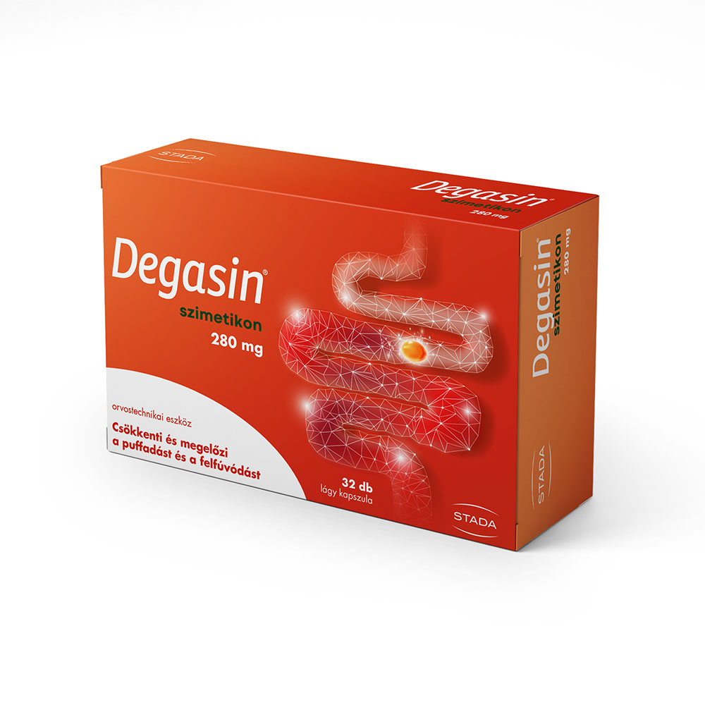 DEGASIN 280 mg lágy kapszula (32db)