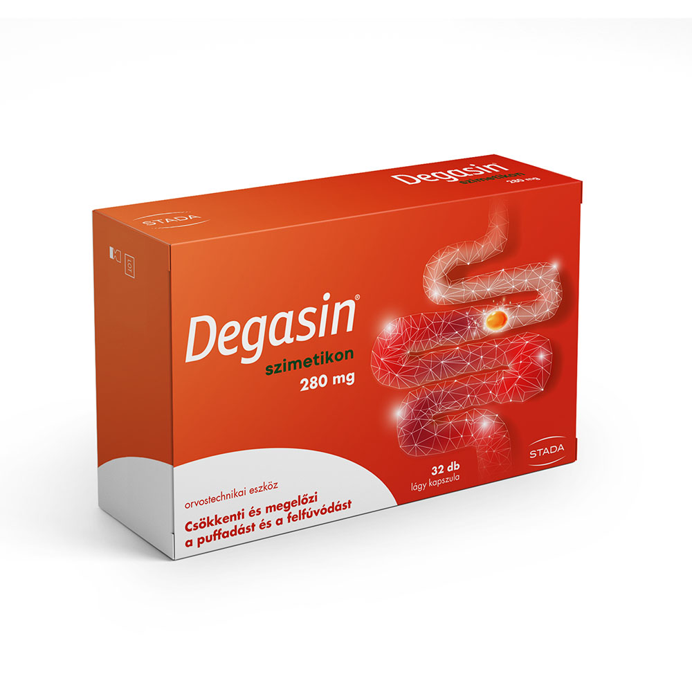DEGASIN 280 mg lágy kapszula (32db)