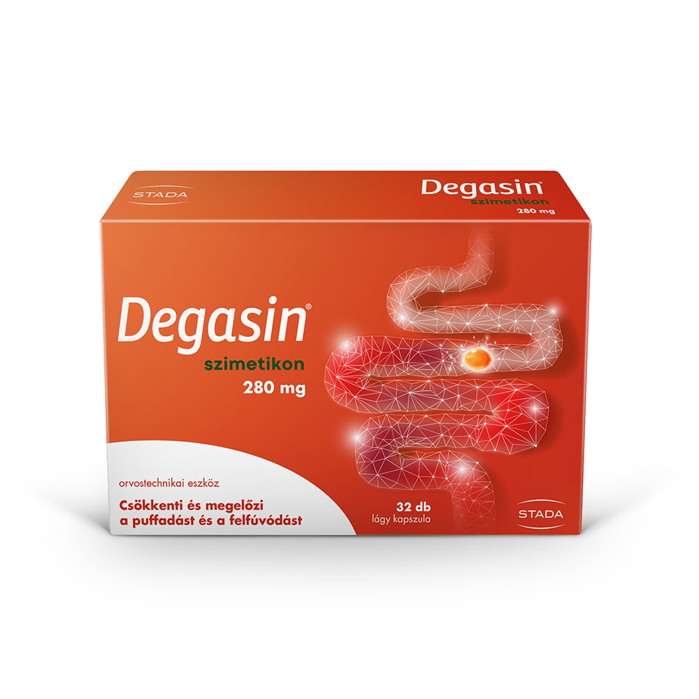 DEGASIN 280 mg lágy kapszula (32db)
